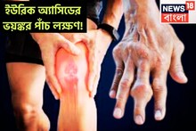 ইউরিক অ্যাসিডের ভয়ঙ্কর পাঁচ লক্ষণ! এড়িয়ে গেলেই পড়তে হবে বড় ফাঁদে