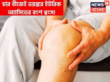 চার বীজেই ভয়ঙ্কর ইউরিক অ্যাসিডের বংশ ধ্বংস! রাতে শুতে যাওয়ার আগে মুখে নিলেই ব্যথার শেষ