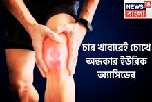 চার খাবারেই ইউরিক অ্যাসিড ঠান্ডা! ভয়ঙ্কর-ব্যথা যন্ত্রণা থেকে মুক্তি, হাড় থেকে বের করবে