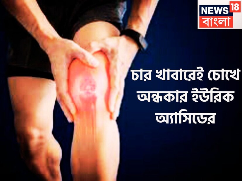 শরীরে ইউরিক অ্যাসিডের সমস্যা বাড়তে শুরু করলেই নানান ধরনের উপসর্গ দেখা দিতে থাকে শরীরে ৷ যার মধ্যে অন্যতম হল ব্যথা যন্ত্রণা ৷ প্রতীকী ছবি ৷