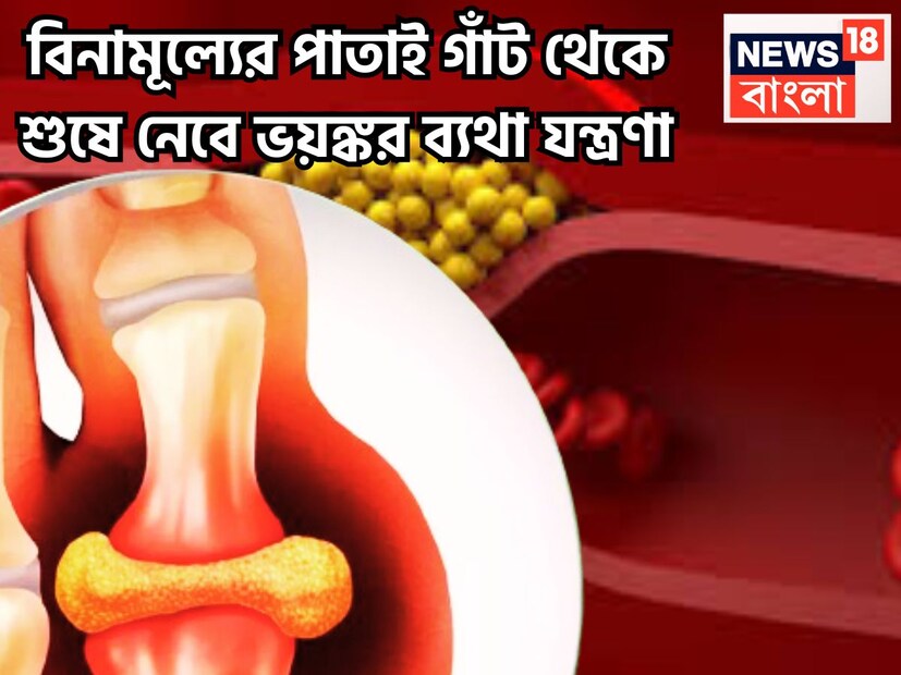 শরীরে ইউরিক অ্যাসিডের সমস্যা বাড়তে শুরু করলে তখনই পানই মুক্তি দিতে পারে ৷ প্রতীকী ছবি ৷