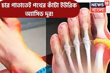 এক নয় দুই নয় চার পানীয়তেই কাহিল! ইউরিক অ্যাসিডের ভয়ঙ্কর রূপ ফ্যাকাসে