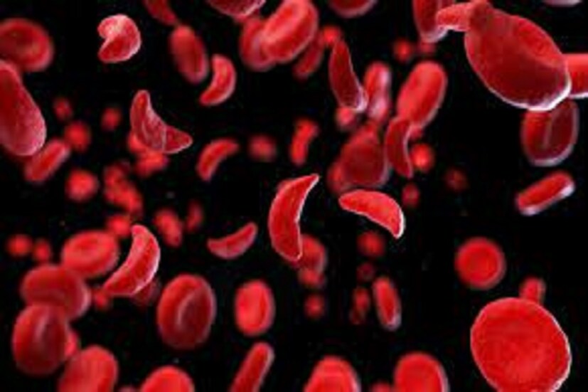 AB ব্লাড গ্রুপের (AB Blood Group) মানুষেরা অত্যন্ত পরিমাণে ইচিবাচক ও আত্মবিশ্বাসী হয়ে থাকেন ৷ প্রচুর পরিমাণে স্মার্ট ও বুদ্ধিদীপ্ত হয়ে থাকেন ৷ প্রতীকী ছবি ৷