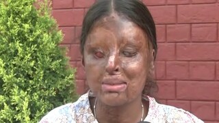 CBSE-তে ৯৫ শতাংশ নম্বর পাওয়া অ্যাসিড আক্রান্ত কাফি Photo Courtesy: ANI