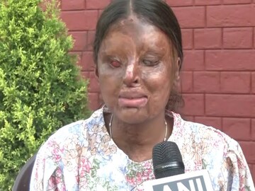 CBSE-তে ৯৫ শতাংশ নম্বর পাওয়া অ্যাসিড আক্রান্ত কাফি Photo Courtesy: ANI