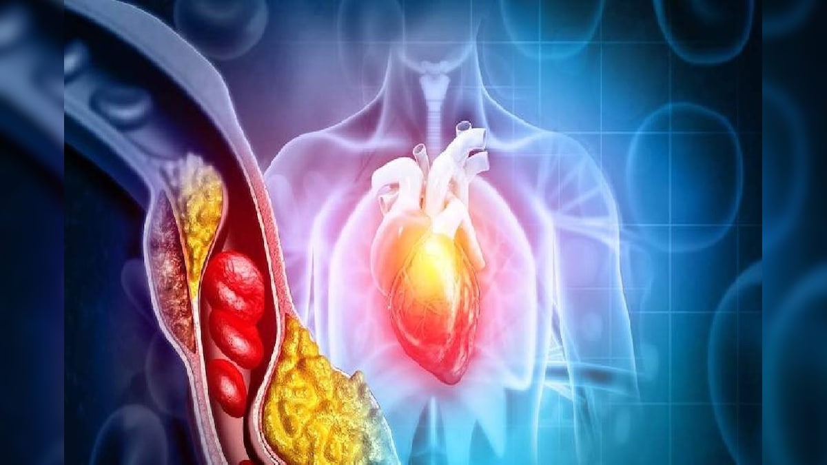 know 5 reasons for sudden cholesterol increase in body avoid negligence