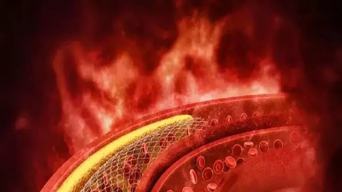 সকালে খালি পেটে এই ৩ ড্রাই ফ্রুটসেই মিলবে দারুণ রেজাল্ট! হরহর করে নামবে খারাপ কোলেস্টেরল