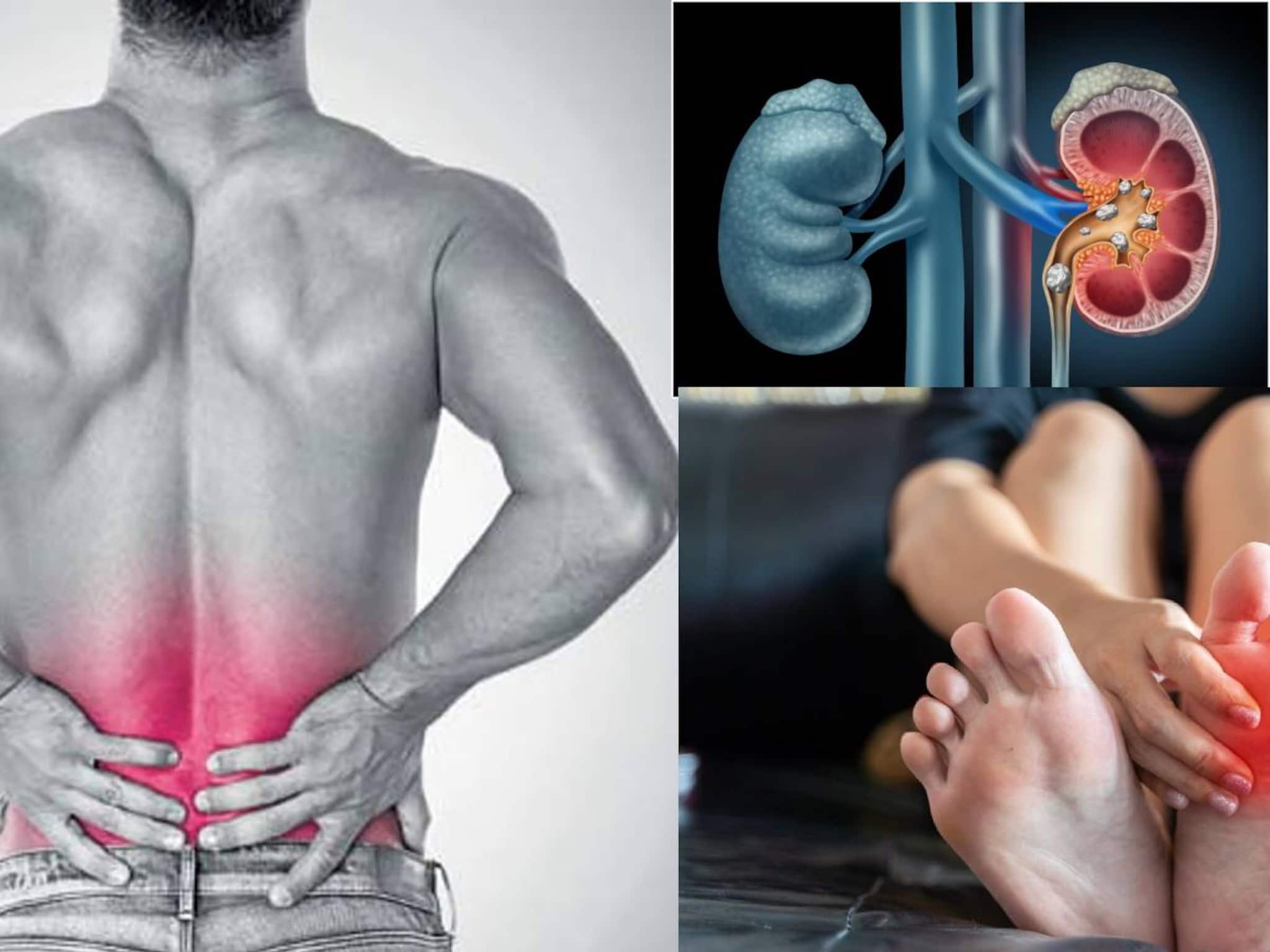 শীতের বাজারে থরেথরে সাজানো! এই সবজিকে বলা হয় 'মহৌষধ'... মারণ রোগ 'ক্যানসার'-এরও যম, 'কিডনি' তে পাথরের 'রামবাণ'