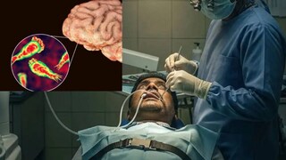 সংক্রমিত স্যালাইন ব্যবহার করার সময় ব্যাকটেরিয়া স্নায়ুপথ দিয়ে প্রবেশ করে (AI Generated Image) সংক্রমিত স্যালাইন ব্যবহার করার সময় ব্যাকটেরিয়া স্নায়ুপথ দিয়ে প্রবেশ করে (AI Generated Image)