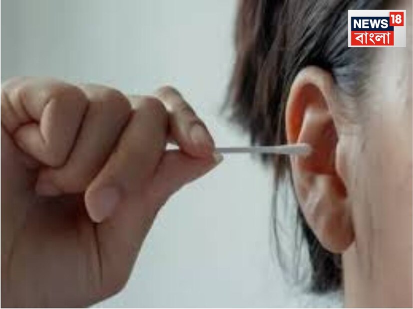 স্টিম বা গরম জলের ভাপ গরম জলের ভাপ নিলে কানের মোম নরম হয়ে যায় এবং ধীরে ধীরে নিজে থেকেই বেরিয়ে আসে।