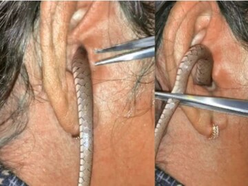 Snake Viral Video: মহিলার কানে ঢুকে আস্ত সাপ! টেনেও বের করা যাচ্ছে না, তারপর? দেখুন সেই ভয়ঙ্কর ভিডিও…