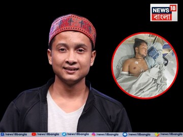 Pawandeep Accident:  হাসপাতালে ভর্তি, ভেঙেছে হাত-পা…মারাত্মক দুর্ঘটনার কবলে ‘ইন্ডিয়ান আইডল’ চ‍্যাম্পিয়ন পবনদীপ!