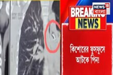 কিশোরের ফুসফুসে আটকে পিন! সফল অস্ত্রোপচার কলকাতা মেডিক্যালে