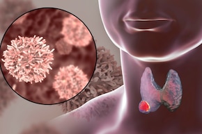 থাইরয়েডের ওষুধ খান? ফুলকপি, সয়াবিনের মতো আর যে যে খাবার এড়িয়ে চলবেন