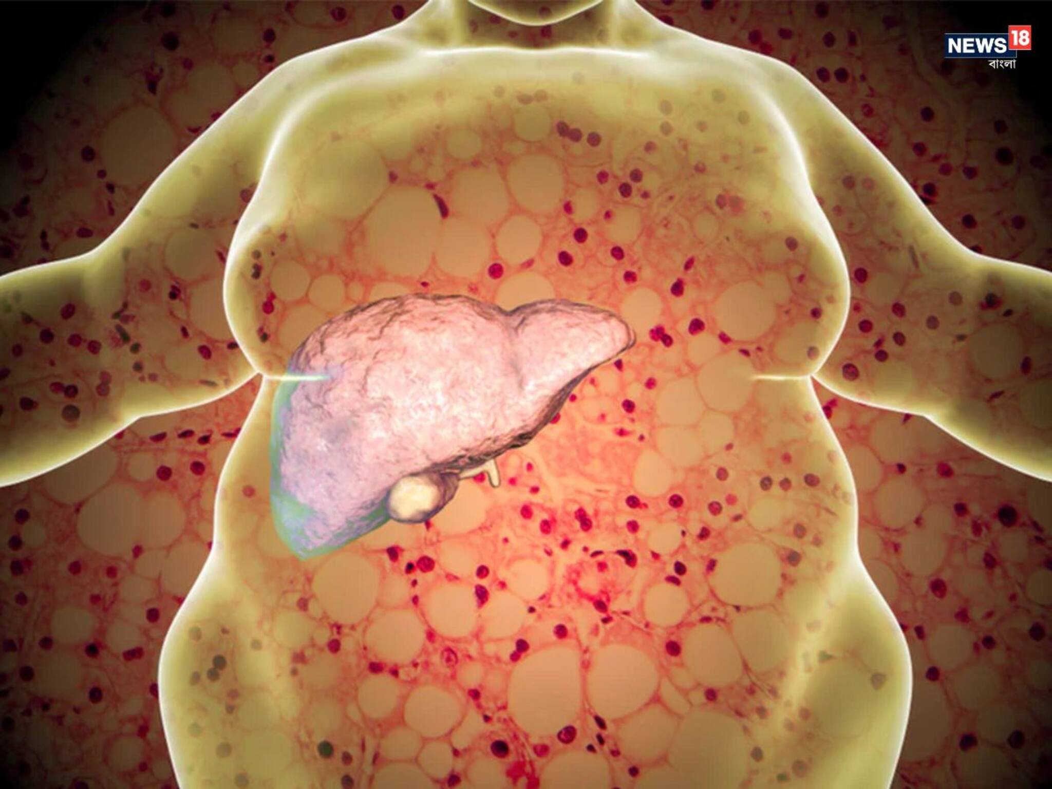 Fatty Liver Cure: লিভার ঠিক থাকলে শরীর ঠিক! ফ্যাটি লিভার কমাতে কফি, গ্রিন টি, বিটরুট জুস অপরিহার্য