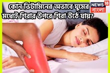 রাতে হঠাৎ হঠাৎ ঘুম ভাঙে! কোন ভিটামিনের অভাবে গভীর নিদ্রায় শিরার উপরে শিরা উঠে পড়ে