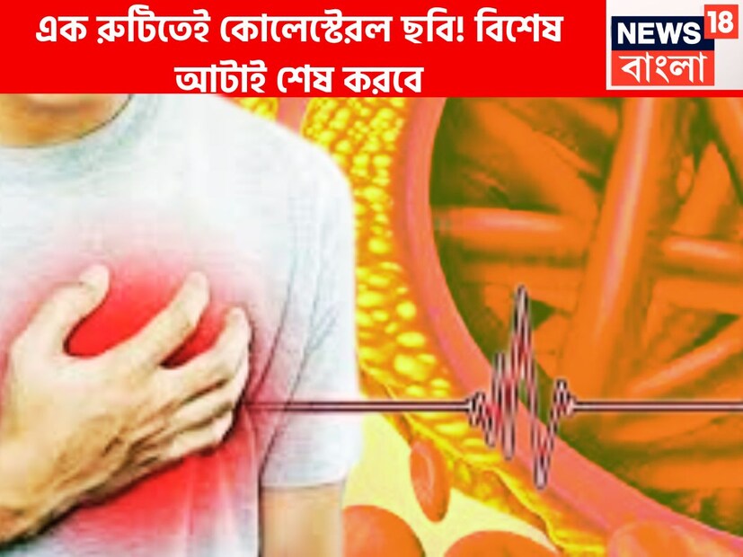 কোলেস্টেরলে শরীরকে বিভিন্ন ভাবে বিপদে ফেলে, শিরায় শিরায় জমে থাকে বরফের মত যদি সঠিক সময়ে রুখে দাঁড়ানো না যায় তবে বড়সড় বিপর্যয় হতে পারে ৷ প্রতীকী ছবি ৷