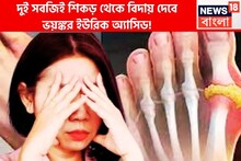 দুই সবজিতেই ইউরিক অ্যাসিডের যন্ত্রণা কাহিল! শিকড় থেকে উপড়ে ফেলবে ব্যথা-দুর্দশা!