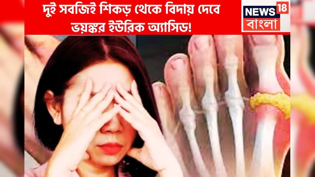 High Uric Acid Control Tips: দুই সবজিতেই ইউরিক অ্যাসিডের যন্ত্রণা কাহিল! শিকড় থেকে উপড়ে ফেলবে ব্যথা-দুর্দশা! High Uric Acid Control Tips: দুই সবজিতেই ইউরিক অ্যাসিডের যন্ত্রণা কাহিল! শিকড় থেকে উপড়ে ফেলবে ব্যথা-দুর্দশা!