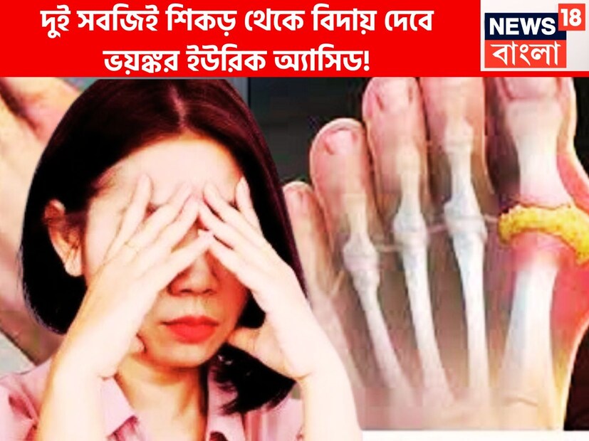 ইউরিক অ্যাসিডের পরিমাণ সীমানা ছাড়ালেই বিপদ দেখা দেয় ৷ প্রতিটি মানুষেরই শরীরে ইউরিক অ্যাসিড নির্দিষ্ট পরিমাণে থাকে ৷ প্রতীকী ছবি ৷