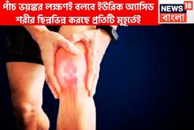শরীরের পাঁচ লক্ষণ ভয়ঙ্কর! এড়িয়ে গেলেই মহাবিপদ, শরীর ছিন্নভিন্ন করবে ব্যথা যন্ত্রণা