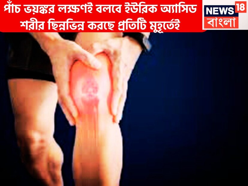 শরীরে প্রস্তুত ইউরিক অ্যাসিড আসলে একটি অত্যন্ত ভাল প্রোডাক্ট ৷ এটি ভাঙলে পিউরিন তৈরি হয়ে থাকে ৷ প্রধানত কিডনি ছেঁকে ইউরিক অ্যাসিড শরীর থেকে বের করে দেয় ৷ প্রতীকী ছবি ৷