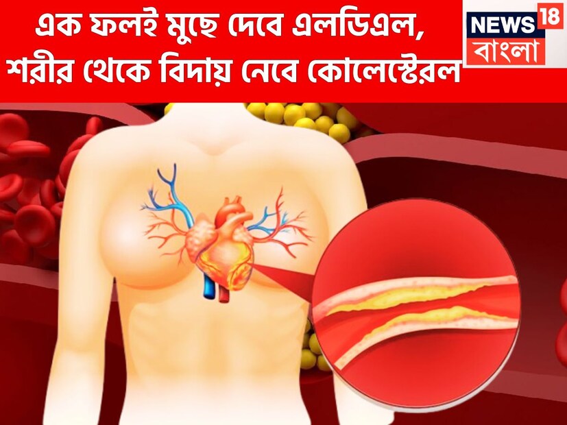 সারা দেশের সঙ্গে সঙ্গে বিশ্বব্যাপি বিভিন্ন রোগের ঘেরাটোপে বহু মানুষ ৷ সুগার, প্রেশার, থাইরয়েডের সঙ্গে সঙ্গে কোলেস্টেরলও দিনের পর দিন ভয়ঙ্কর রূপ ধারণ করছে ৷ প্রতীকী ছবি ৷