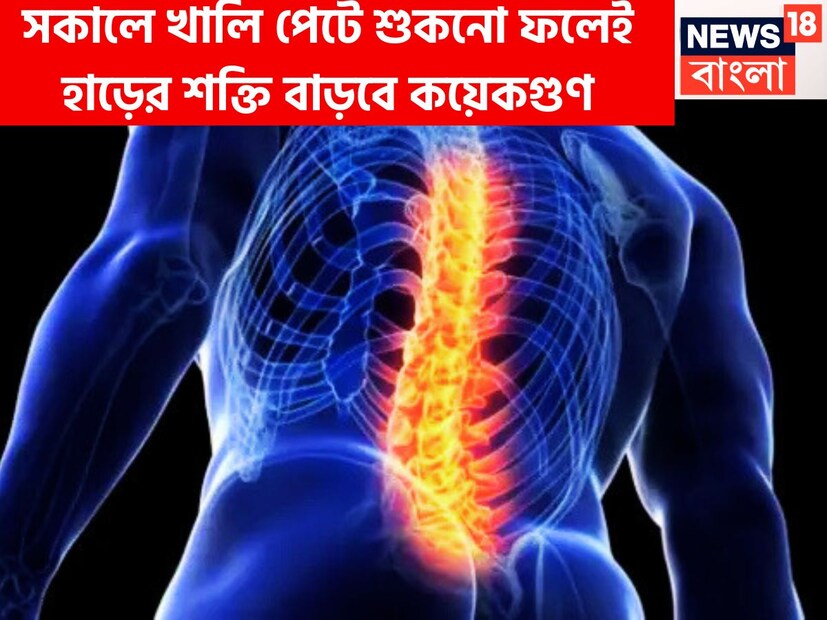 প্রতিদিন সকালে ঘুম থেকে উঠে খেয়ে নিন এই ড্রাইফ্রুট অঙ্গ অঙ্গ থেকে হবে শক্তির সঞ্চয় ৷ বিশাল শক্তিতে শরীর হবে দুরন্ত ৷ প্রতীকী ছবি ৷
