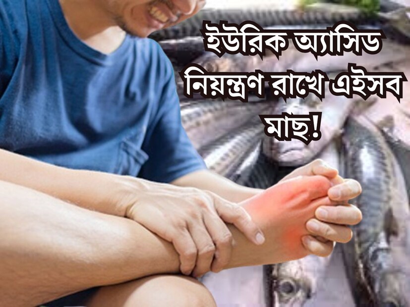 দেহের অন্দরে চলতে থাকা একাধিক সমস&#x200d;্যার একটি বড় কারণ হল ইউরিক অ&#x200d;্যাসিড। অস্বাস্থ&#x200d;্যকর জীবনযাপন থেকে শুরু ভুলভাল খাওয়া দাওয়া বিভিন্ন কারণে শরীরের মধ&#x200d;্যে বেড়ে যায় ইউরিক অ&#x200d;্যাসিডের মাত্রা। 