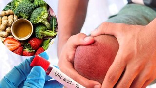 পিউরিন সমৃদ্ধ খাবার খেলে শরীরে ইউরিক অ্যাসিডের পরিমাণ বেড়ে যায় পিউরিন সমৃদ্ধ খাবার খেলে শরীরে ইউরিক অ্যাসিডের পরিমাণ বেড়ে যায়