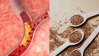 কয়েক দিনের মধ্যেই শিরায় জমা কোলেস্টেরল দূর হয়ে যাবে