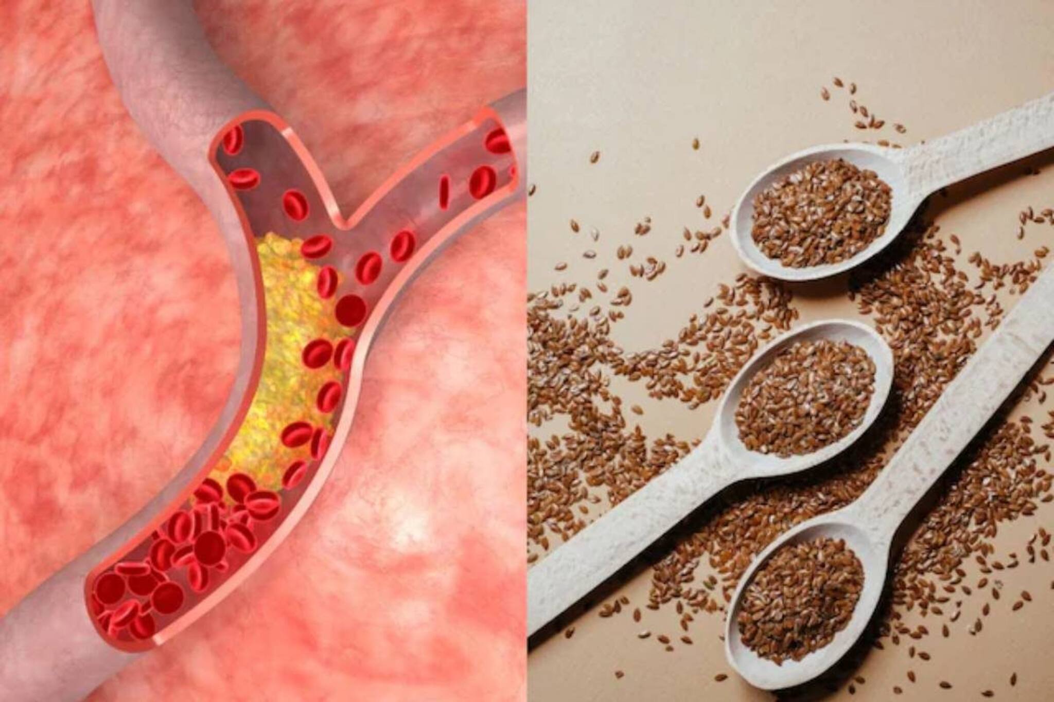 কোলেস্টেরলের সমস্ত চিহ্ন ধুয়েমুছে সাফ করে এই ছোট্ট দানা! রোজ জাস্ট ১ চামচ! বুঝবেন ফারাক!