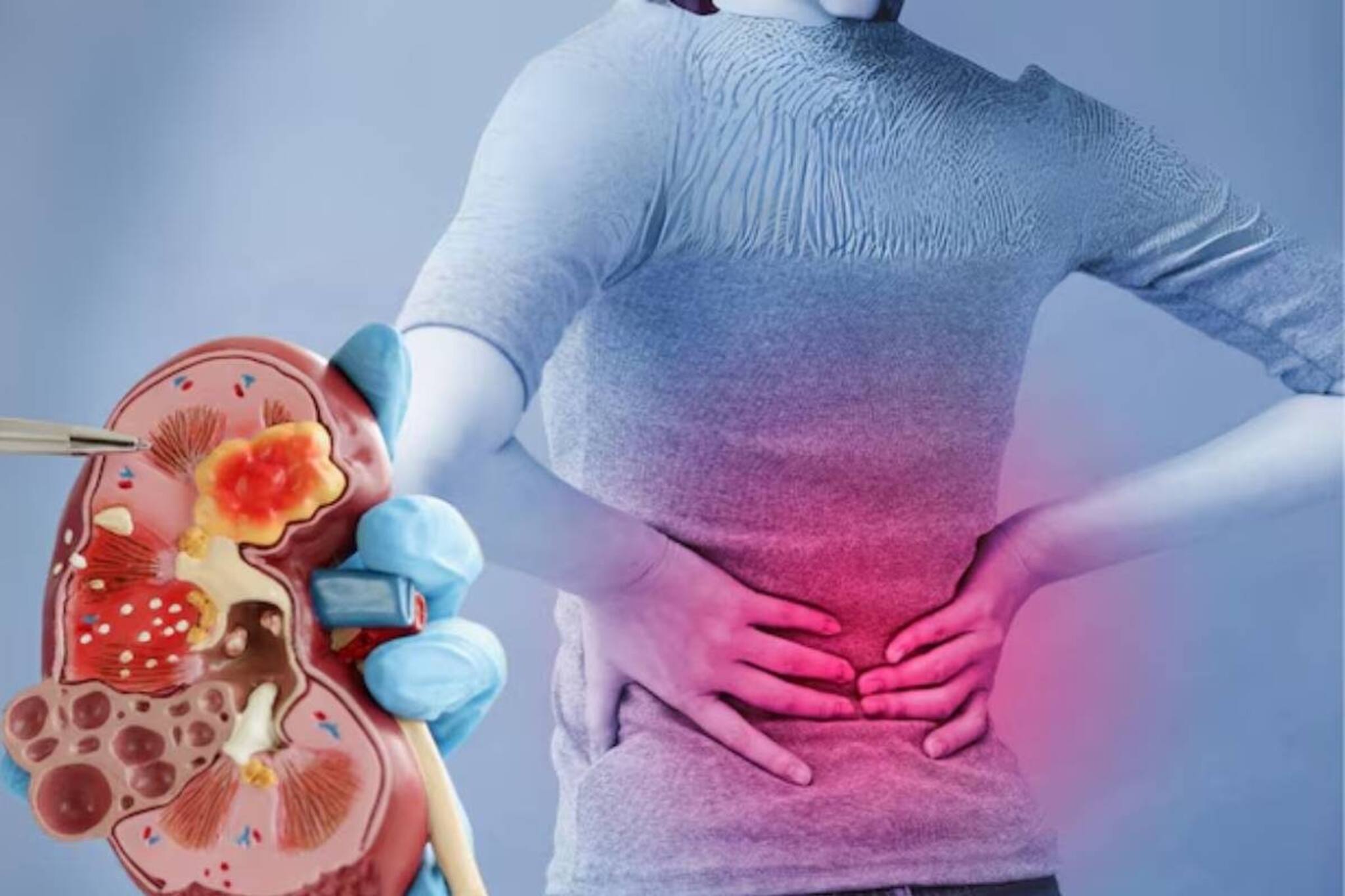 জমবে পাথর! ছেঁকে ধরবে কিডনির রোগ! ভুলেও খাবেন না এই ৫ খাবার! আজই মুছে ফেলুন ডায়েট থেকে!