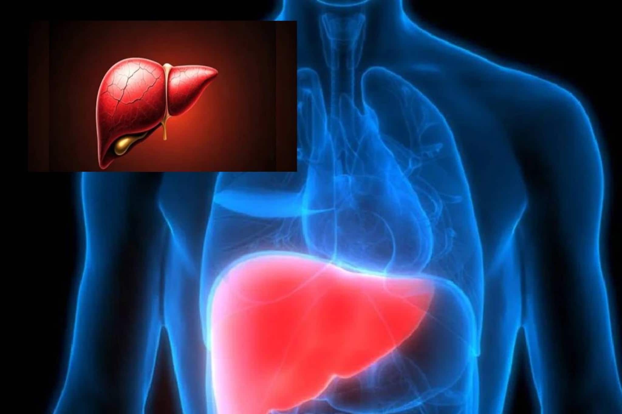 কয়েক ফোঁটা লেবুর রসেই পরিষ্কার লিভার! চর্বি জমে ধরে না পচন! দূরে থাকে ক্যানসারের ছোবল