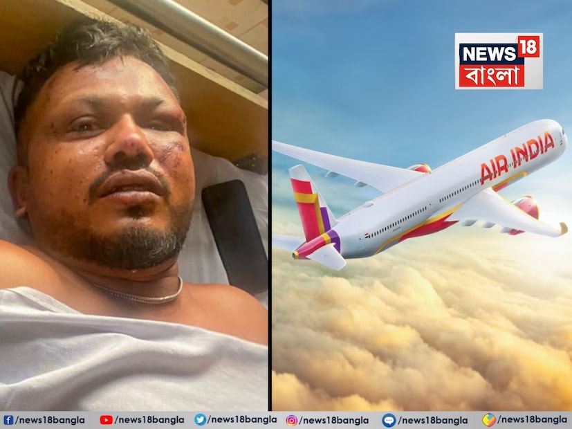 এয়ার ইন্ডিয়া বিমান ধ্বংসের একটি নতুন ভিডিও প্রকাশিত হয়েছে যেখানে এয়ার ইন্ডিয়া-১৭১ প্লেন ক্র্যাশের একমাত্র জীবিত ব্যক্তি, বিশ্বাসকুমার রমেশ, আহমেদাবাদ ক্র্যাশ সাইট থেকে হেঁটে বেরিয়ে আসছেন।