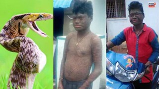 সাপের মতো শরীর! 