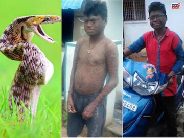সাপের মতো শরীর! 