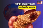 সতর্ক না থাকলে লাস্ট স্টেজে ধরা পড়বে,পেটের 'এরকম' ব্যথা হলে গাফিলতি করবেন না,আজই testকরান