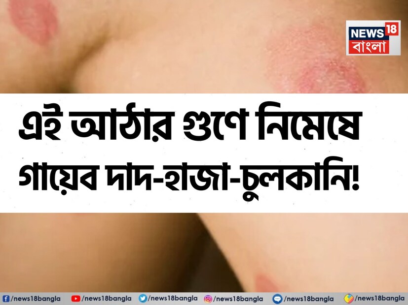 বর্ষাকাল শুরু হওয়ার সাথে সাথে আর্দ্রতা, ঘাম এবং আর্দ্রতা বৃদ্ধি পায়। এই তিনটির সংমিশ্রণে ত্বকে ছত্রাকের সংক্রমণের যুদ্ধ শুরু হয়। দাদ, খোস-পাঁচড়া এবং চুলকানির সমস্যায় ভুগছেন এমন ব্যক্তিরা অ্যালোপ্যাথিক ক্রিম এবং লোশনের জন্য হাজার হাজার টাকা ব্যয় করেন, তবুও তাঁরা উপশম পান না।