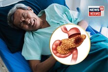 পেটের 'এই' ৩ সাধারণ সমস্যা মানেই 'প্যানক্রিয়াস' ক্যানসার...! আপনার শরীরে একটিও নেই তো?