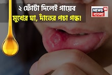 মুখের ভিতর ২ ফোঁটা! তুড়ি মেরে কমান ঘায়ের জ্বালা আর ফোলা মাড়ি! উধাও দাঁতের পচা দুর্গন্ধ