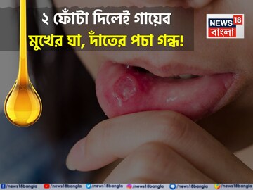 মুখের ভিতর ২ ফোঁটা! তুড়ি মেরে কমান ঘায়ের জ্বালা আর ফোলা মাড়ি! উধাও দাঁতের পচা দুর্গন্ধ