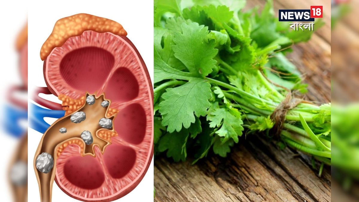 Green coriander juice can be beneficial for the kidney, know the right time and way to drink it