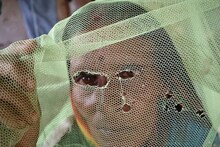সর্বনাশ! নদিয়ায় এ কোন রোগের হানা! ভারতে এসে আক্রান্ত এক বাংলাদেশি! এমন অবস্থা, ছুটে এল হু