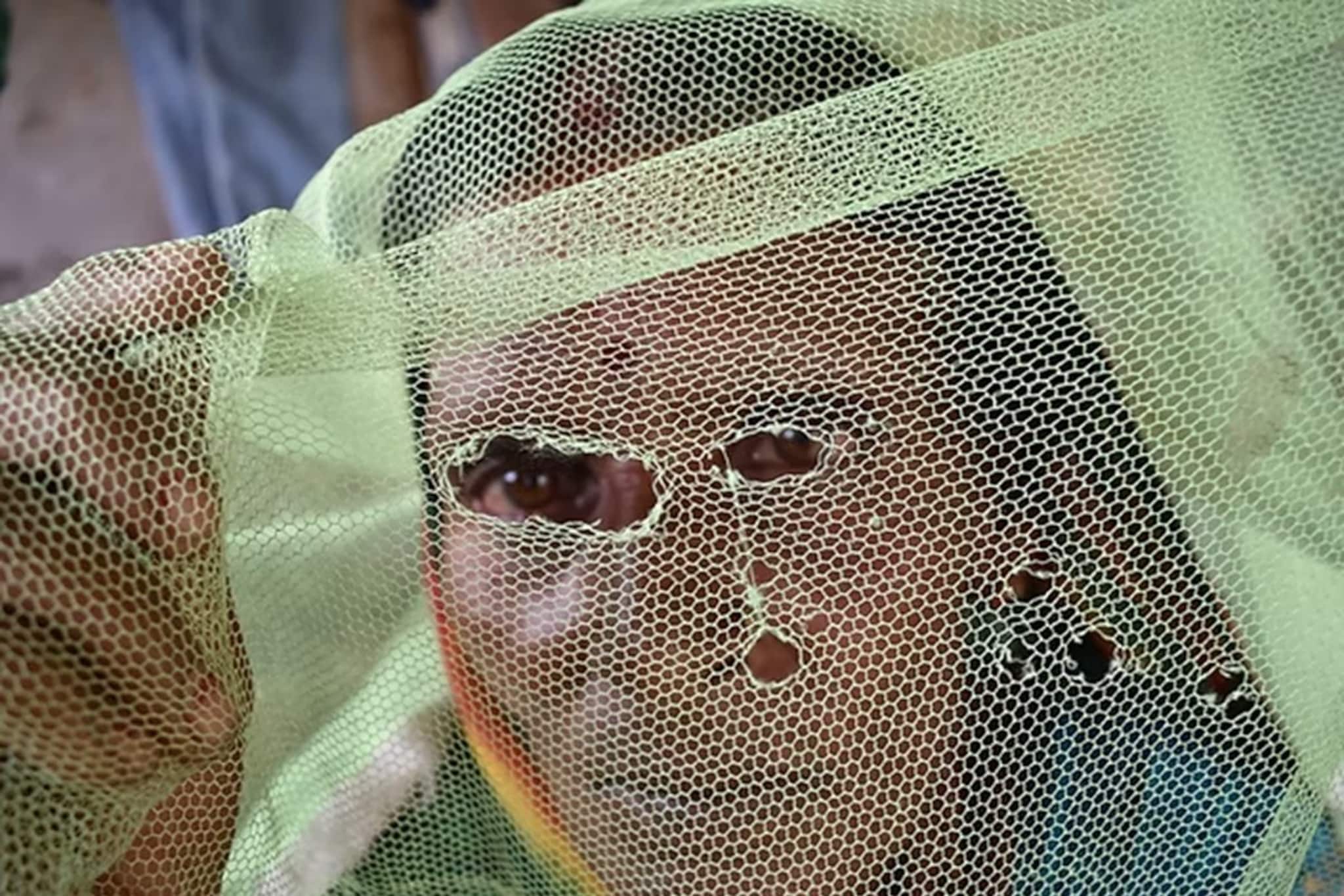 সর্বনাশ! নদিয়ায় এ কোন রোগের হানা! ভারতে এসে আক্রান্ত এক বাংলাদেশি! এমন অবস্থা, ছুটে এল হু