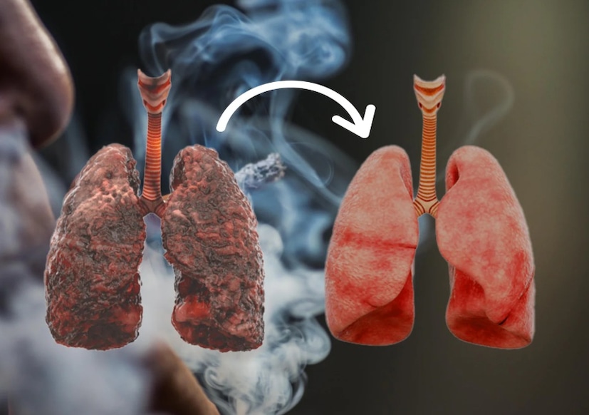 Lungs: সস্তার এই ‘আয়ুর্বেদিক’ ওষুধ ফুসফুস ‘ছেঁকে পরিষ্কার’ করবে, দূরে সরিয়ে রাখবে হাপানি-লাংস ক্যানসার মতো বিপজ্জনক রোগ Lungs: সস্তার এই ‘আয়ুর্বেদিক’ ওষুধ ফুসফুস ‘ছেঁকে পরিষ্কার’ করবে, দূরে সরিয়ে রাখবে হাপানি-লাংস ক্যানসার মতো বিপজ্জনক রোগ