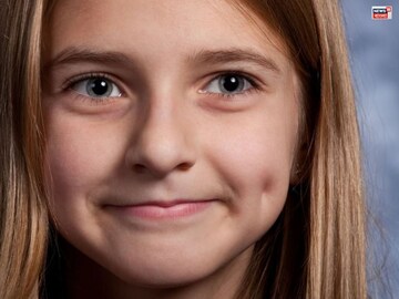 গালে টোল পড়ছে? সৌন্দর্যের মাত্রা বাড়িয়ে দেয়, কিন্তু জানেন কি  টোল আসলে একটি রোগ?