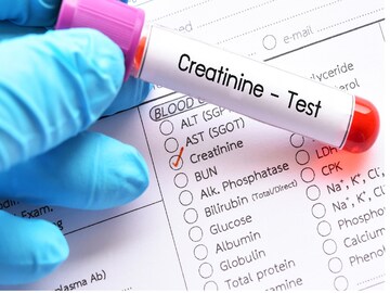ক্রিয়েটিনিন বাড়া মানেই নষ্ট হচ্ছে কিডনি,রোজের যে যে অভ্যাসে বশে থাকবে ক্রিয়েটিনিন
