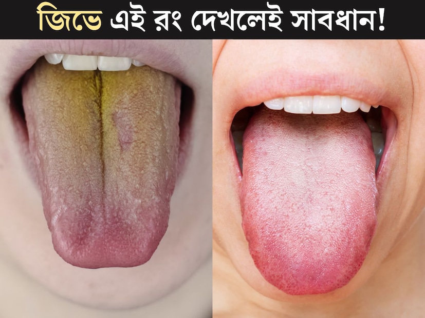 শারীরিক সমস&#x200d;্যা নিয়ে চিকিত্&#x200d;সকের কাছে গেলে, তিনি সবার প্রথমে টর্চ দিয়ে ভাল করে জিভ পরীক্ষা করেন। শরীরের মধ&#x200d;্যে সমস&#x200d;্যা যাই হোক, সব ছেড়ে জিভই কেন পরীক্ষা করেন ডাক্তারবাবু? কারণ জিভ দেহের স্বাস্থ&#x200d;্যের দর্পণ বা আয়নার মতো কাজ করে। 