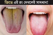 হলুদ, লাল...জিভে এই কয়েকটি রং দেখলেই সাবধান! দেহে বাসা বেঁধেছে কোন রোগ?কোন অঙ্গে সমস‍্যা